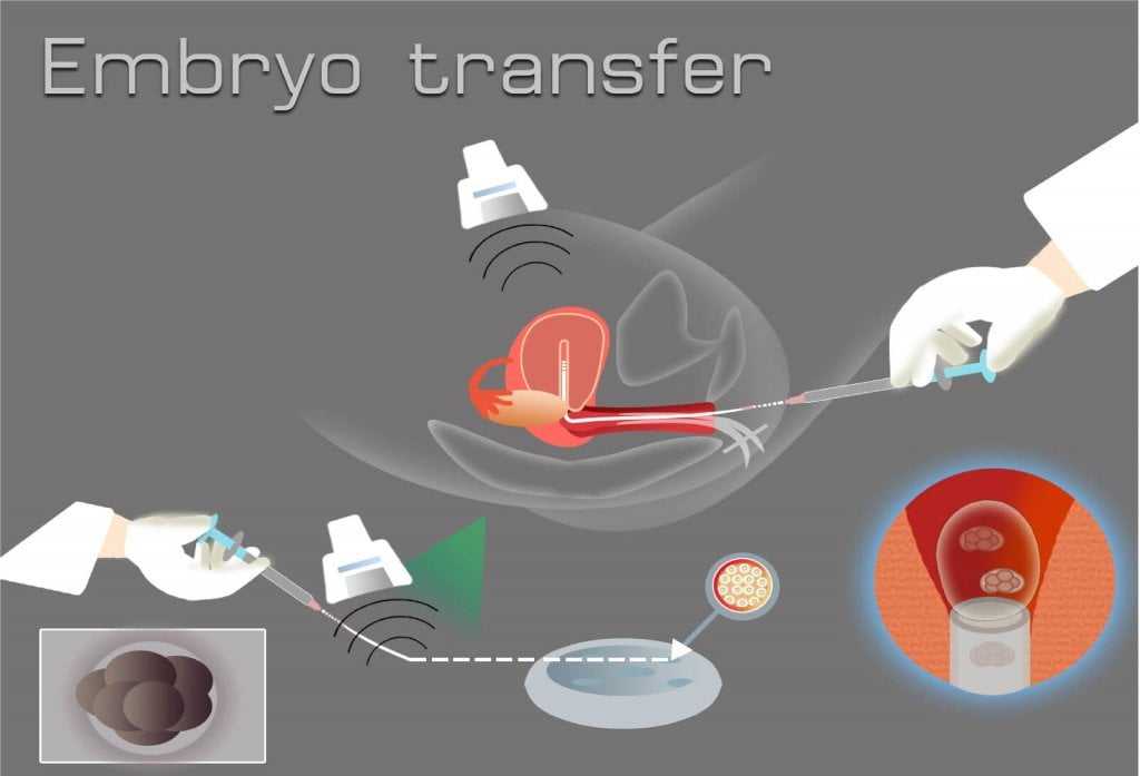 embriyo transferi