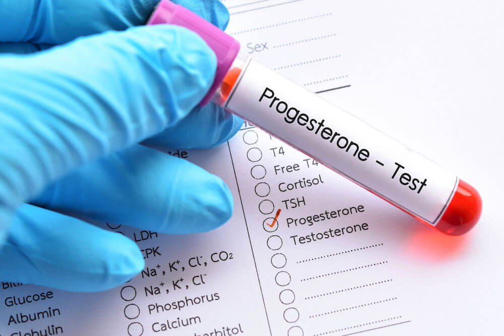 Progesteron Hormonu testi nasıl yapılır