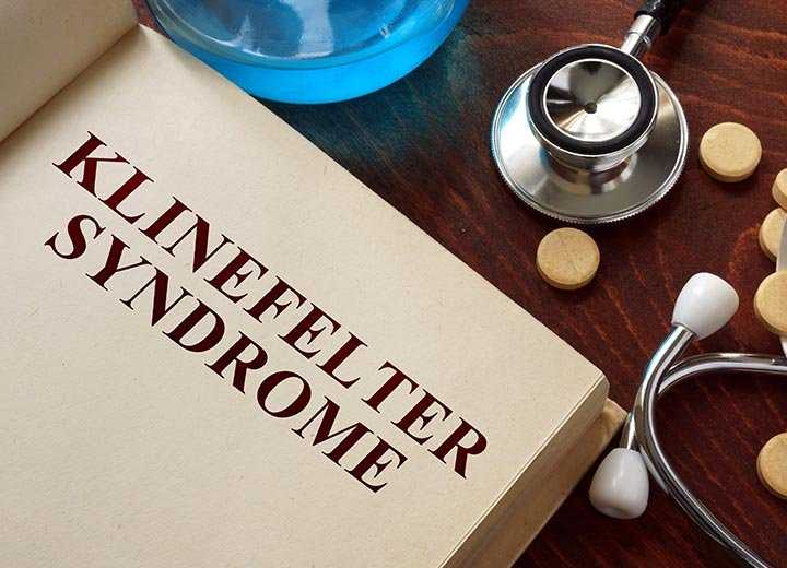 Klinefekter-sendromu
