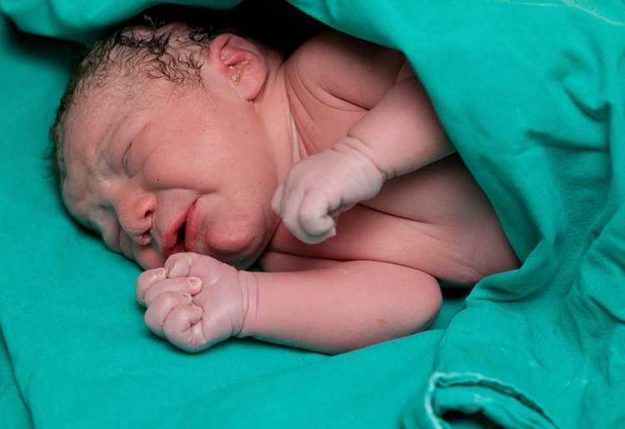 Prezentasyon-Bozuklugu