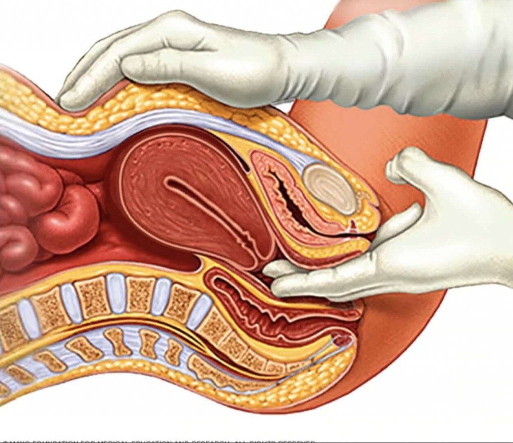 Pelvik muayene:
Pelvik muayene sırasında doktor iki parmağını vajinaya sokar. Bu sırada karnınızdan baskı yapar ve rahim, yumurtalık ve diğer pelvik organların değerlendirmesini yapabilir. 