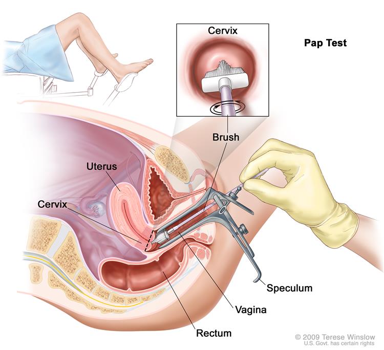 pap smear 